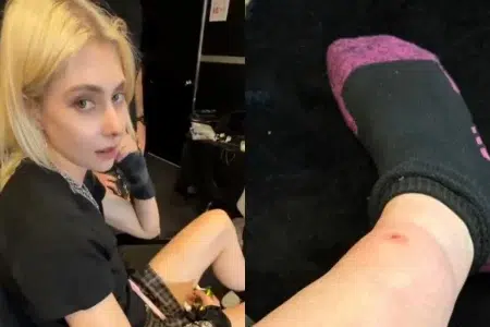 Taylor Momsen fue picada por una araña venenosa antes de telonear a AC/DC Taylor Momsen