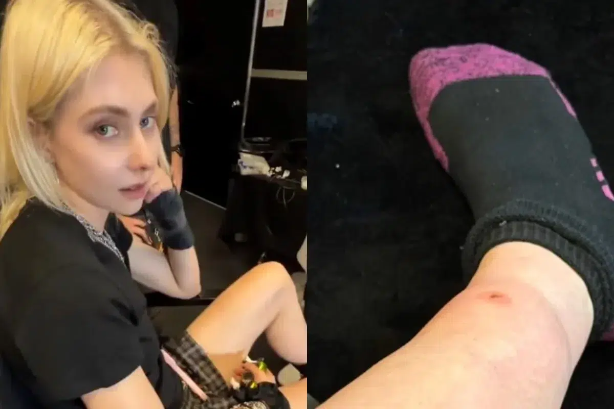 Taylor Momsen fue picada por una araña venenosa antes de telonear a AC/DC Taylor Momsen